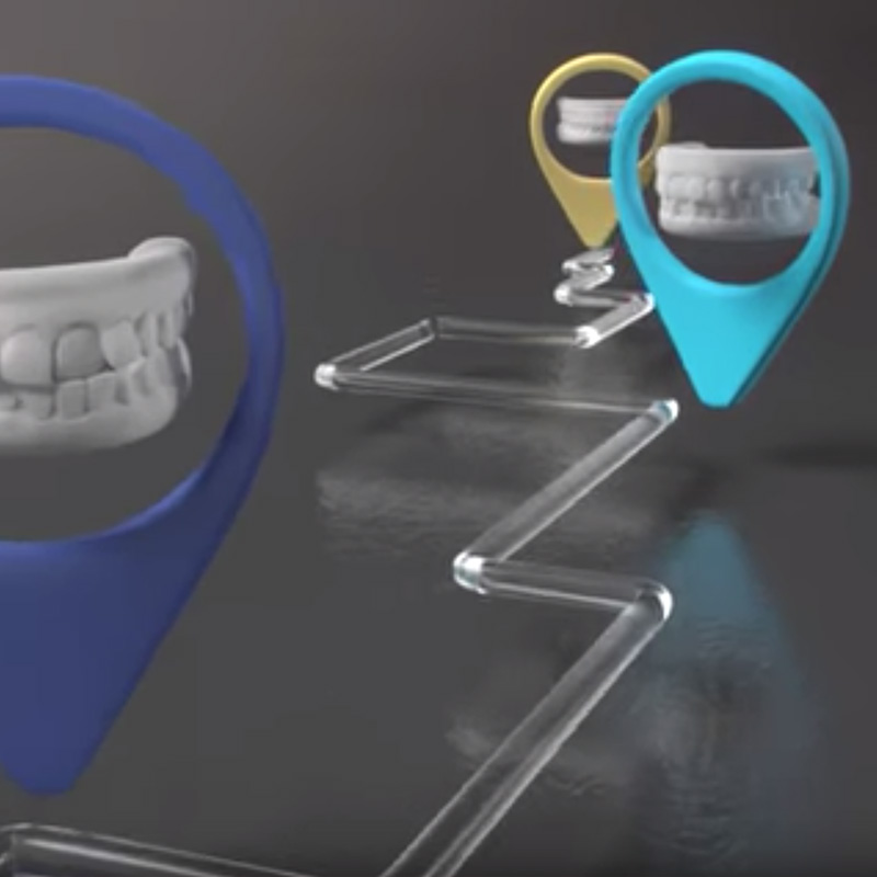 what is invisalign video