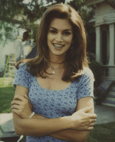 Cindy-Crawford-with-braces-treatment