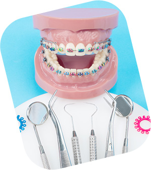 Orthodontic Treatment Illustration