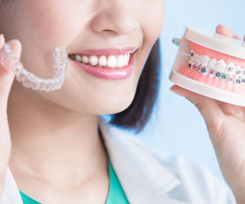 braces and invisalign choice for a patient