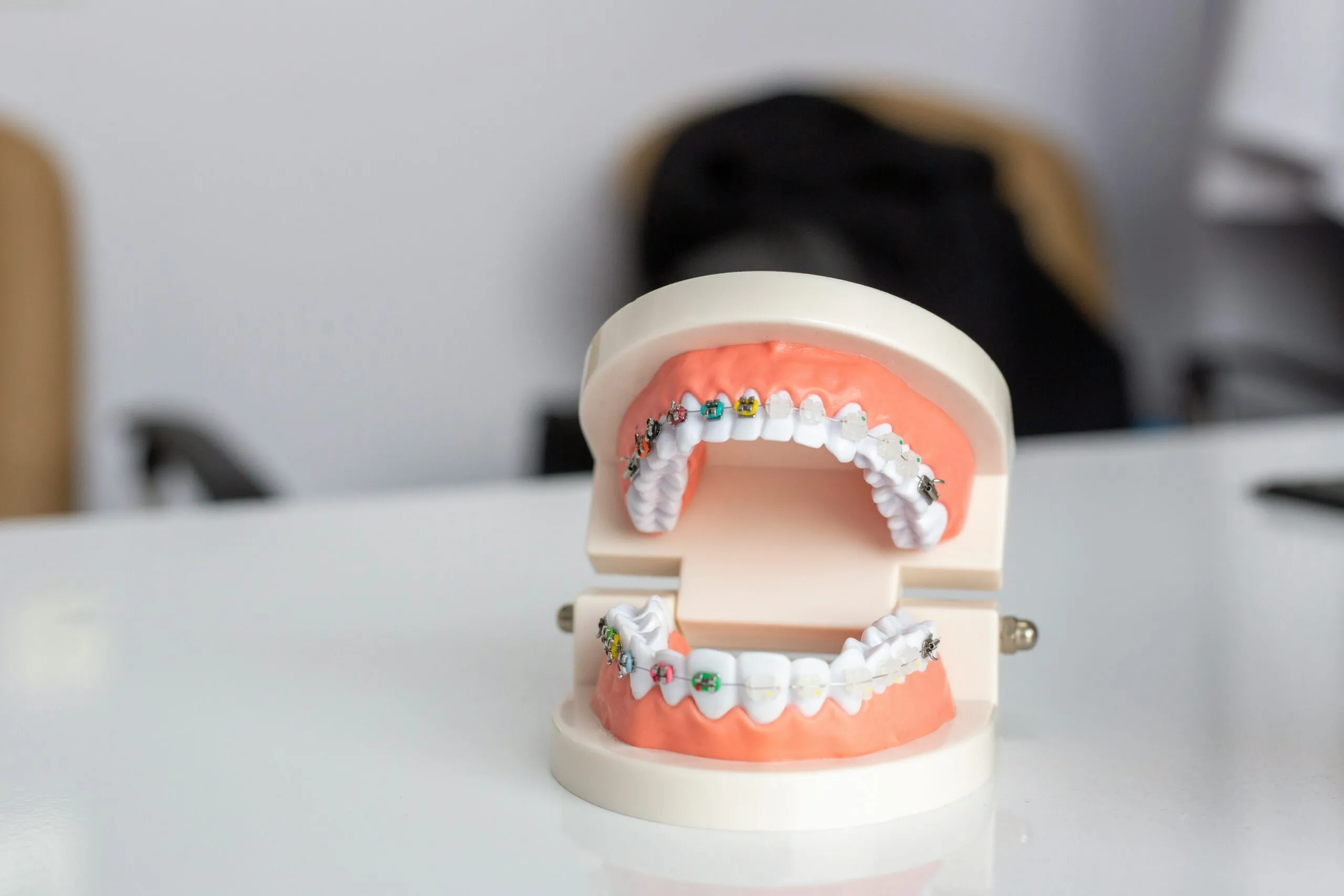 Common orthodontic issues