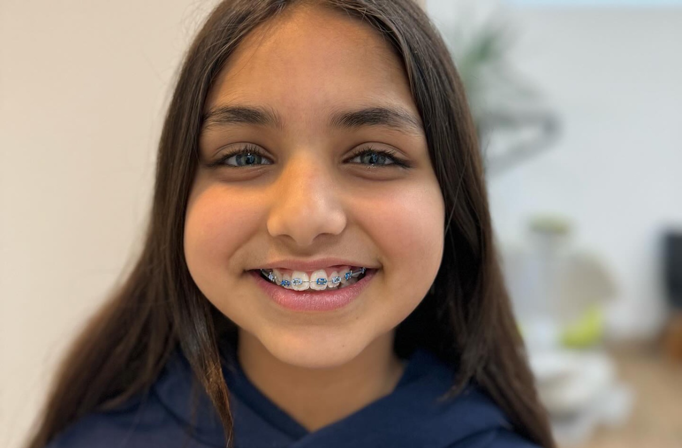 Braces for Kids
